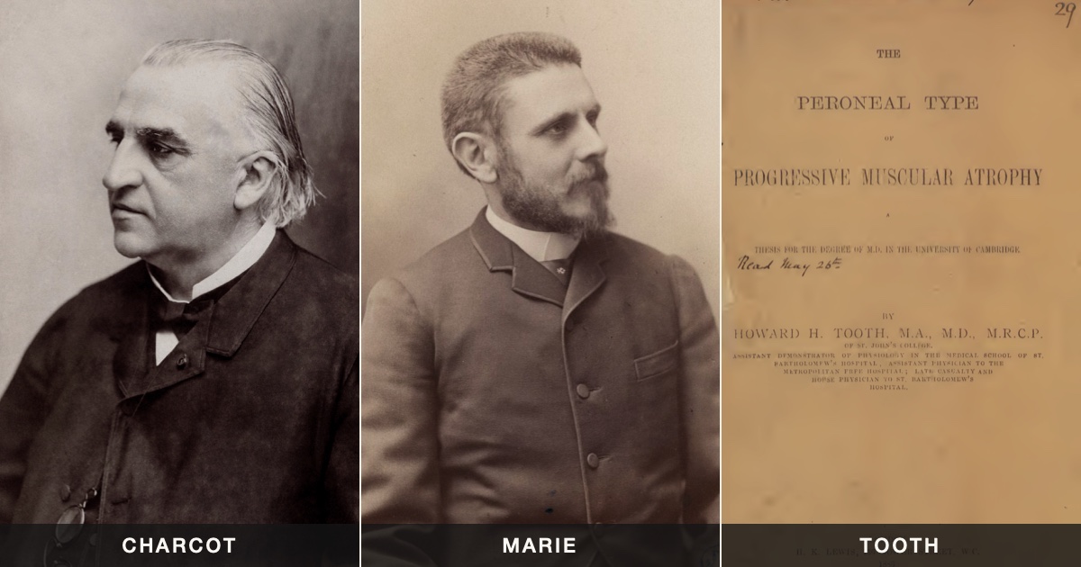 Portraits of the neurologists Jean-Martin Charcot and Pierre Marie beside the title page of Howard Henry Tooth's 1886 thesis on the peroneal type of progressive muscular atrophy, labelled Charcot, Marie and Tooth.